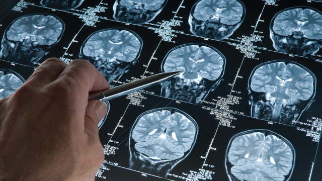 You Actually Use All of Your Brain, Not 10%