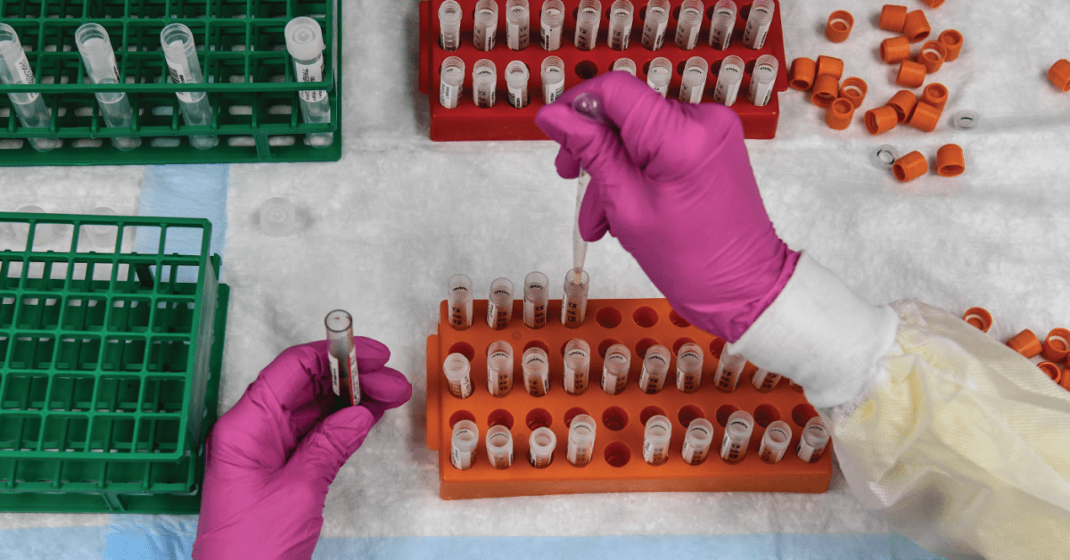 Photo shows a lab technician sorting blood samples for COVID-19 vaccination study at the Research Centers of America in Hollywood, Florida on August 13, 2020. (Photo by CHANDAN KHANNA/AFP)